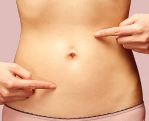 abdominoplastia sem corte