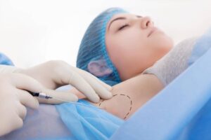 Braquioplastia: entenda a cirurgia plástica dos braços