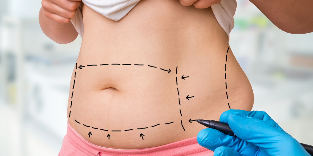 Quando posso retornar ao trabalho após uma cirurgia plástica - AC Clínica